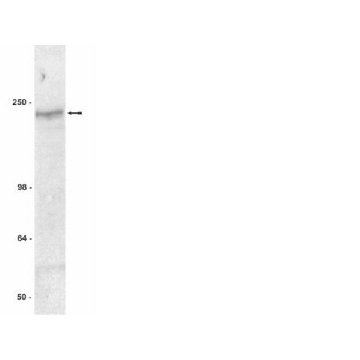 Anti-CFTR Antibody, clone MM13-4，200UG，05-581，Sigma