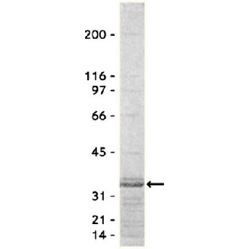 Rho检测试剂（Rhotekin RBD，琼脂糖），650 µg，650UG，14-383，Sigma