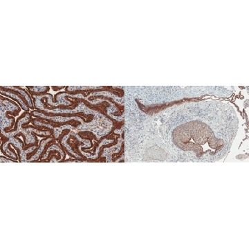 Anti-Mesothelin Antibody, clone MN-1，100UG，MABC1140-100UG，Sigma