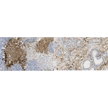 Anti-MMP-11 (Stromelysin-3) Antibody, clone 5ST-4A9，100UG，MABC1607，Sigma