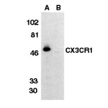 Anti-C-X-X-X-C Chemokine Receptor 1 Antibody, extracellular loop，100UG，AB1891，Sigma
