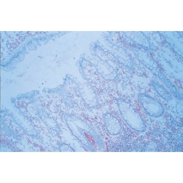 Anti-ICAM-1 Antibody, clone P2A4，100UG，MAB2146，Sigma