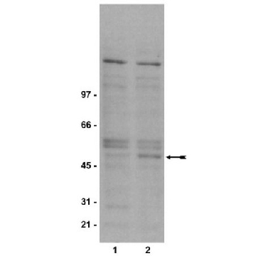 抗磷酸化-GSK3β（Ser9）抗体，克隆2D3，100UG，05-643，Sigma