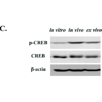 抗磷酸化-CREB (Ser133) 抗体，100UL，06-519，Sigma