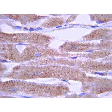 Anti-Potassium Channel KvLQT1 Antibody, CT，100UG，AB5932，Sigma