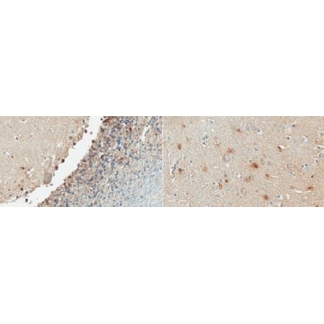 Anti-SK2 (KCa2.2) Antibody, clone K78/29，100UG，MABN1832，Sigma