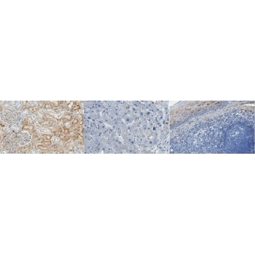 Anti-Complement C3a/C3a (desArg) Antibody, clone K13/16，25UL，MABF1978-25UL，Sigma