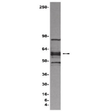 ChIPAb+ LEF1 - ChIP经验证的抗体和引物组，25ASSAYS，17-604，Sigma