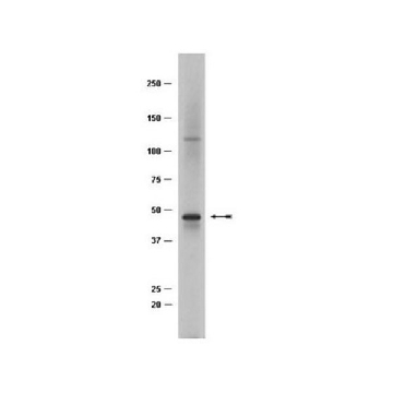 Anti-TAL-1 Antibody, clone BTL73，100UG，04-123，Sigma