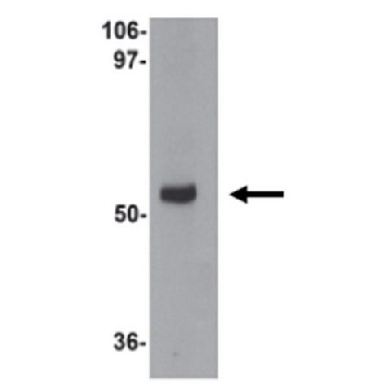 Anti-MYOZAP Antibody，100UG，ABT407，Sigma