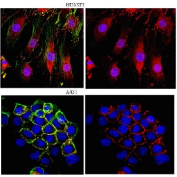 Anti-β-Catenin Antibody，100UG，ABE208，Sigma