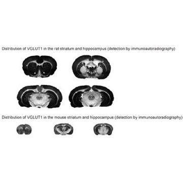 抗-VGluT1，100UL，ABN1647，Sigma