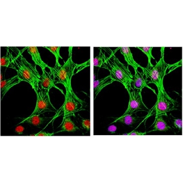 Anti-phospho-p38 (Thr180/Tyr182) Antibody, clone 6E5.2，100UG，MABS64，Sigma