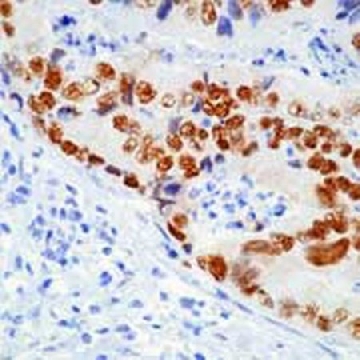 Anti-p53 (Ab-12) (Pantropic) Mouse mAb (DO-7)，100UG，OP140-100UGCN，Sigma