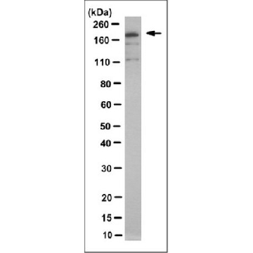 Anti-MRP8 Antibody/ABCC11, clone 2，100UG，MABF275，Sigma