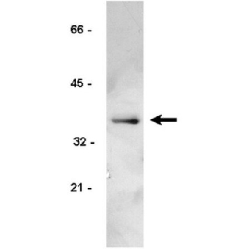 Anti-Cyclin D1/2 Antibody, clone 5D4，100UG，05-362，Sigma