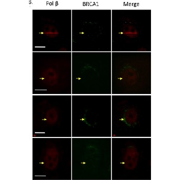 抗-BRCA1（Ab-1）小鼠mAb（MS110），100UG，OP92-100UGCN，Sigma