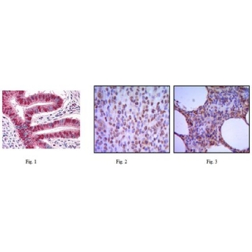Anti-MUM1 Antibody, clone 4G10，100UL，MABC640，Sigma