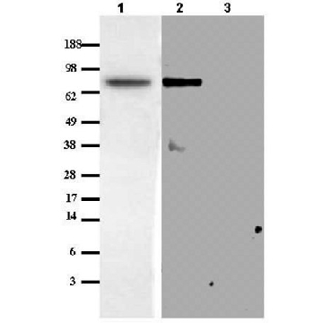 Anti-Matriptase/MT-SP1 Rabbit pAb，50UG，IM1014-50UGCN，Sigma