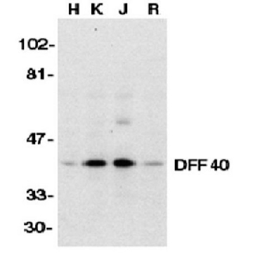 Anti-DFF40 Antibody，100UG，AB16926，Sigma