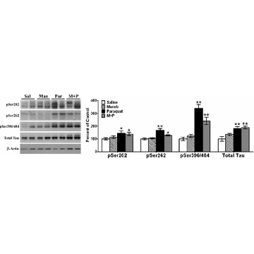 抗-tau抗体，a.a.210-241，克隆Tau-5，100UL，MAB361，Sigma
