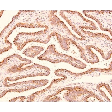 Anti-Trophinin Antibody, clone 3-11，100UL，05-946，Sigma