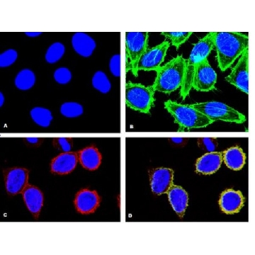 Anti-phospho-p38α(Thr180/Tyr182) Antibody, clone 8.78.8, rabbit monoclonal，100UL，05-1059，Sigma