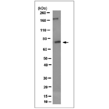 Anti-CD36 Antibody, clone Long 6，100UG，MABT399，Sigma