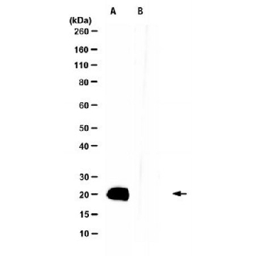 Anti-IL-11 Antibody, clone 12-2E-6G，100UL，MABF3030-100UL，Sigma