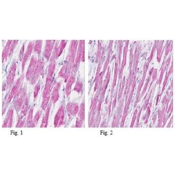 Anti-Myosin 2 Antibody, clone 5B11.1，100UG，MABT25，Sigma