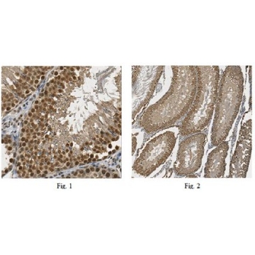 Anti-GLI1 Antibody，100UL，ABC217，Sigma