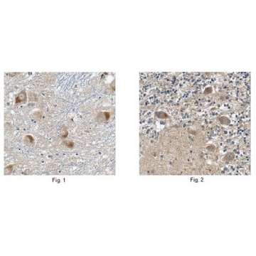Anti-SQSTM1 Antibody, clone 20F1.1，100UG，MABN130，Sigma
