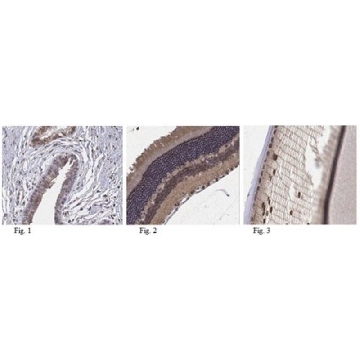 Anti-TTC8 Antibody，100UG，ABN209，Sigma